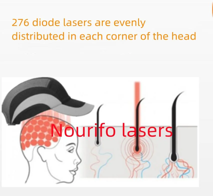 Alopecia Bald Anti Hair Loss Treatment Infrared Lllt Red Light Therapy 272 Diodes Laser Cap Hair Growth Helmet